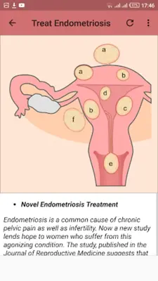 Fertility Treatments android App screenshot 3